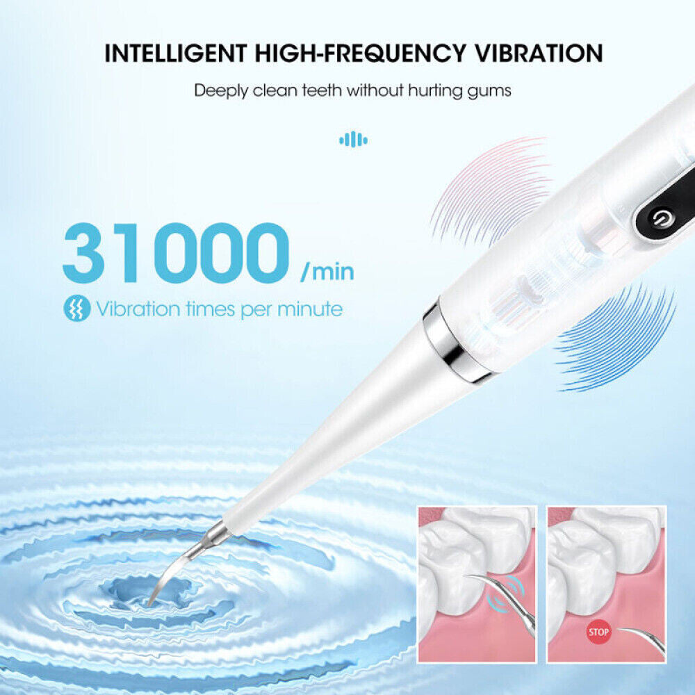 Ultrasonic Electric Tooth Cleaner and Dental Stain Remover Teeth Cleaning Kit